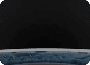 카탈리스 레이저로 정밀 수정체낭 절개