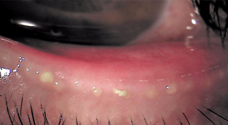 마이봄샘 기능 평가