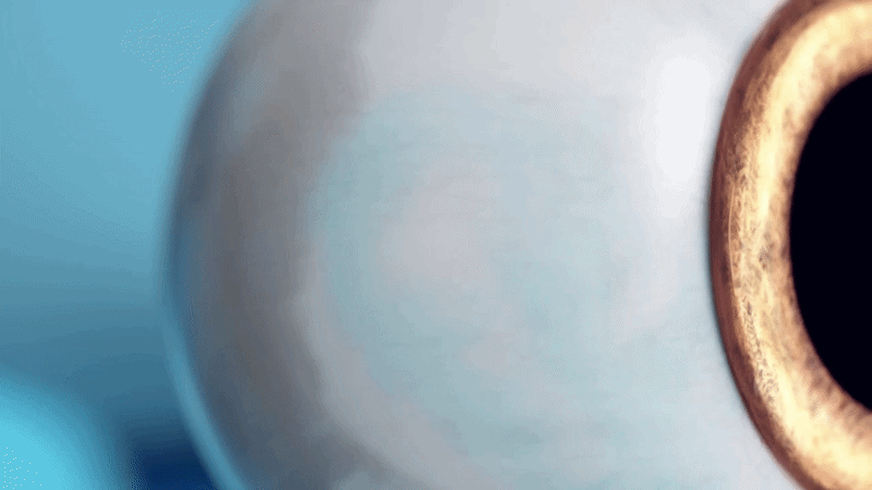 Create corneal peripheral incision