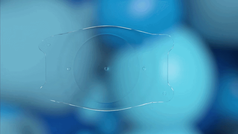 절개창을 통해 렌즈 삽입