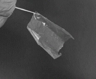 건조 양막 이식