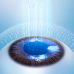 레이저 시력 교정