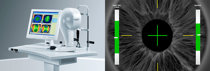 シリウス精密瞳孔診断