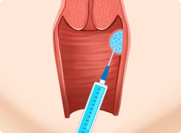 Collagen Stimulation