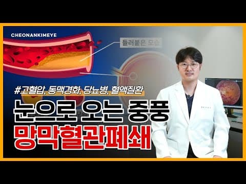 눈으로 오는 중풍, 망막혈관폐쇄!