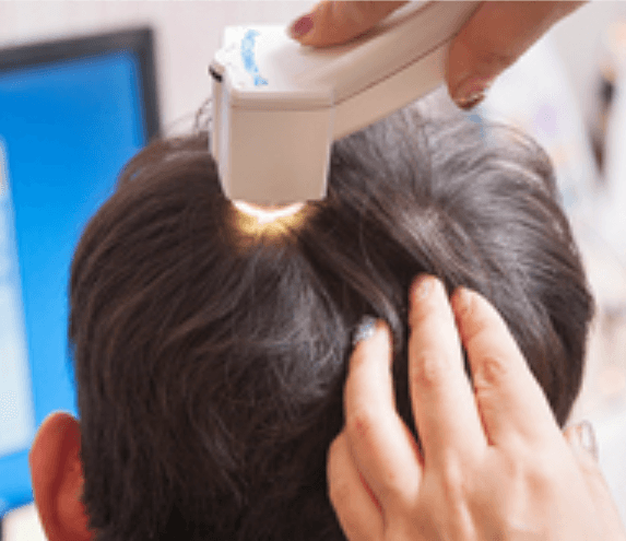 Consultation & Scalp Diagnosis