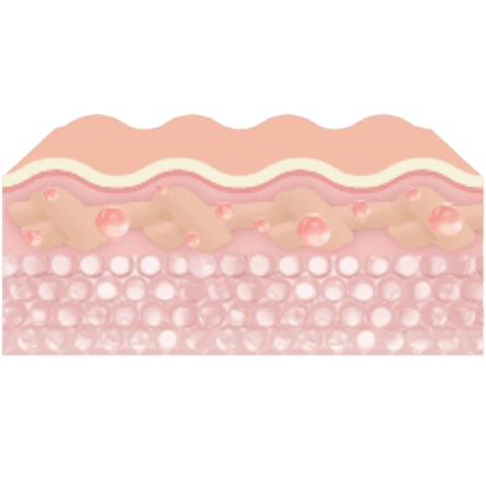 Integration & Regeneration